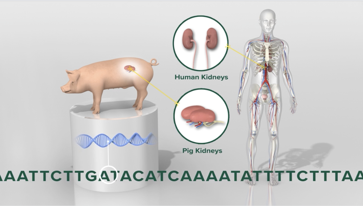 Reel Big Media Creates Animated Video for Pig to Human Kidney Transplant